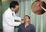 鼻咽癌的發(fā)病因素是什么？鼻咽癌的并發(fā)癥有哪些？