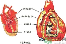 先天性心臟病可以用藥物治療嗎？