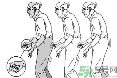 帕金森要注意哪些措施？帕金森的飲食需注意什么？