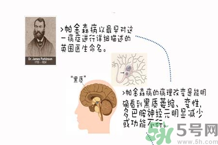 帕金森的治療方法有哪些？