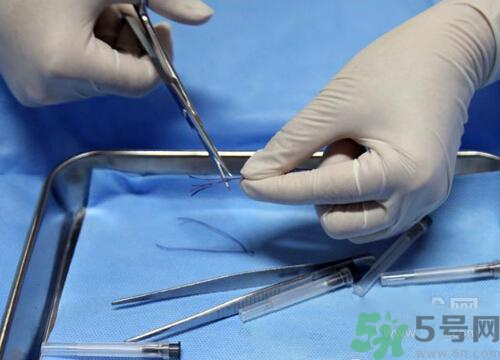 埋線減肥多少錢一次？埋線減肥的副作用