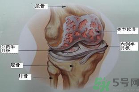 預(yù)防骨病需要注意哪些姿勢？秋季預(yù)防骨病的方法有哪些？