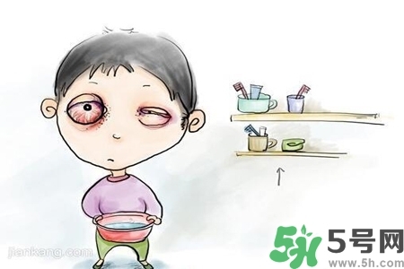 寶寶為什么會感染紅眼??？寶寶患紅眼病如何治療？