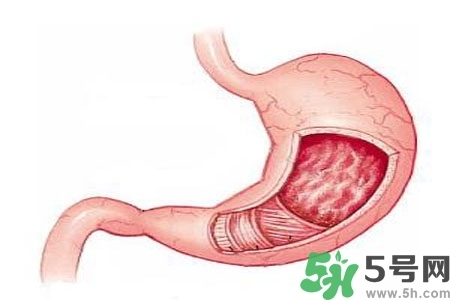急性腸胃炎哪些食物不可以吃？急性腸胃炎不能吃的水果有？