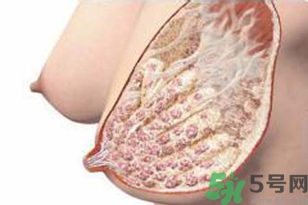 乳腺增生治療方法是什么？乳腺增生的檢查方法有哪些？