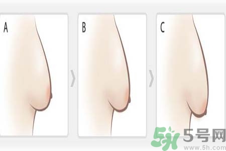 胸部松弛的原因是什么？胸部松弛該怎么辦？