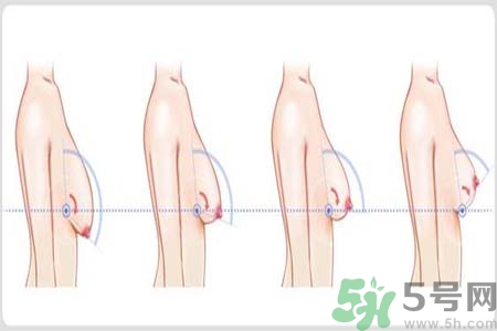 胸部松弛的原因是什么？胸部松弛該怎么辦？