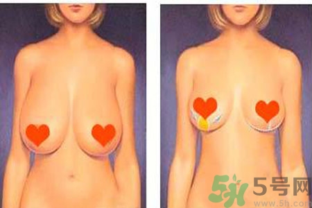 如何預防胸部松弛？吃什么能使胸部挺拔？