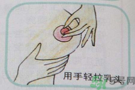 乳頭內(nèi)陷怎么回事？乳頭內(nèi)陷的原因是什么？