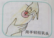 乳頭內(nèi)陷怎么回事？乳頭內(nèi)陷的原因是什么？