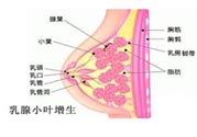 乳腺增生治療方法是什么？乳腺增生的檢查方法有哪些？