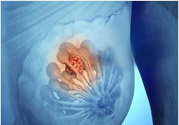 乳房有硬塊正常嗎？乳房有腫塊怎么回事？