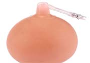 乳頭內(nèi)陷可以拔罐嗎？乳頭內(nèi)陷需要手術(shù)治療嗎？
