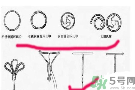 避孕的辦法有什么？避孕的方法有哪些？