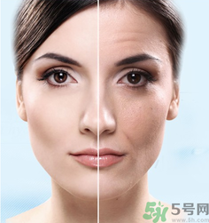 什么是3D液態(tài)拉皮？3D液態(tài)拉皮效果怎么樣？