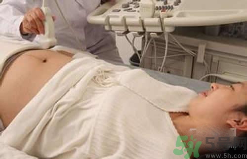 孕婦做b超要空腹嗎？孕婦做b超要不要空腹？