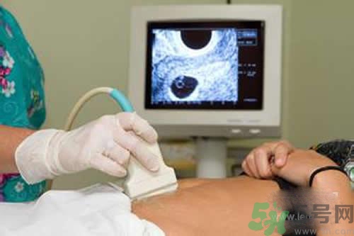 孕婦做b超要空腹嗎？孕婦做b超要不要空腹？