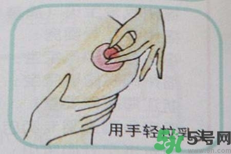 乳頭內(nèi)陷怎么矯正？乳頭內(nèi)陷矯正方法是什么？