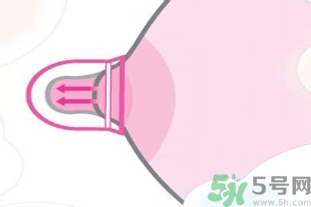 乳頭內(nèi)陷能不能喂奶？乳頭凹陷怎樣哺乳？