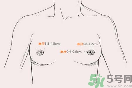 乳頭內(nèi)陷能不能喂奶？乳頭凹陷怎樣哺乳？