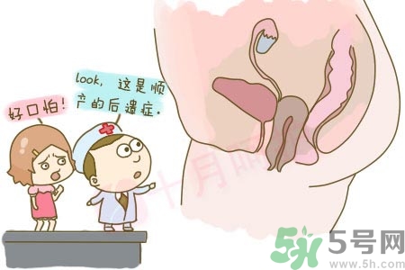 陰道松弛有什么危害？?陰道松弛恢復(fù)的方法有哪些？
