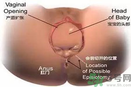 陰道松弛有什么危害？?陰道松弛恢復(fù)的方法有哪些？