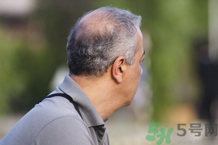 男性更年期的表現(xiàn)有哪些？怎么判斷男性更年期？