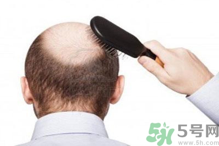 產(chǎn)生中年危機的原因是什么？男性中年危機的好發(fā)年齡？