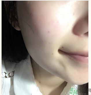 麗得姿面膜適合孕婦可以用嗎？麗得姿面膜哪些孕婦可以用？