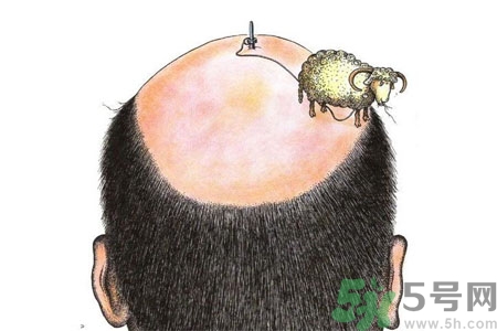 頭發(fā)稀少的原因是什么？如何預(yù)防禿頂?shù)陌l(fā)生？