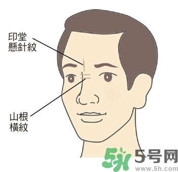 耳垂上有豎紋是怎么回事？山根有橫紋是什么病？