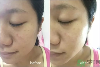 rilastil面膜使用方法 維納斯蒂爾面膜怎么用？