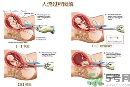 人流后怎么調養(yǎng)身體？人流后飲食需注意什么？
