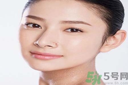 太陽(yáng)穴長(zhǎng)痘怎么辦？如何祛除太陽(yáng)穴上的痘痘？