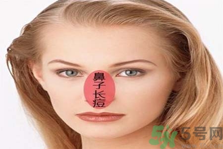 鼻子兩側(cè)長(zhǎng)痘怎么辦？鼻子兩側(cè)長(zhǎng)痘怎么回事？
