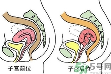 ?子宮移位怎么治療？子宮移位能懷孕嗎？