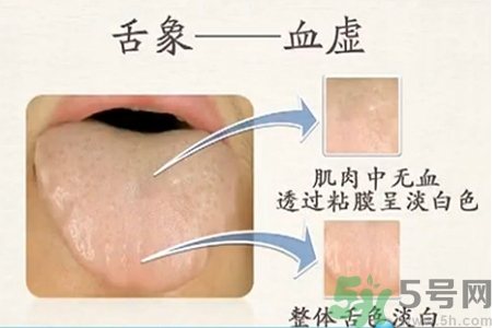 血虛怎么調(diào)理？女人血虛怎么調(diào)理？