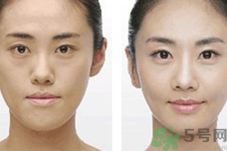 激光縮毛孔多少錢一次？激光縮毛孔一個療程多少錢？