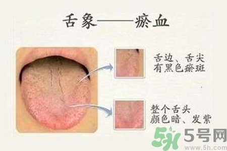 血瘀體質(zhì)吃什么？血瘀體質(zhì)怎么調(diào)理？