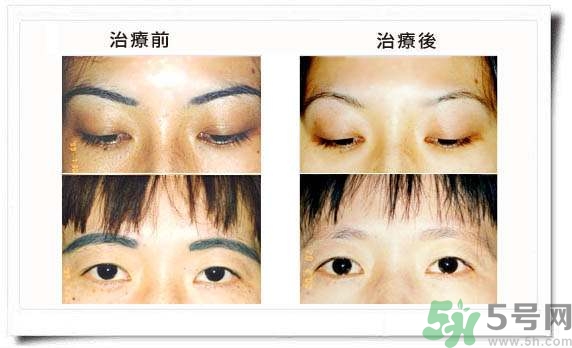 紋眉毛有什么危害？紋眉后注意事項