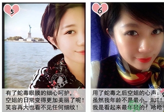 蛇毒眼膜孕婦可以用嗎？ 日本spa蛇毒眼膜孕婦能用嗎？