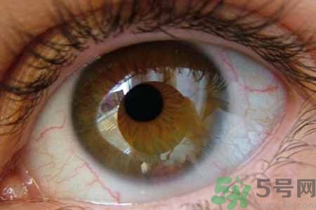 ?干眼癥的治療方法是什么？如何預(yù)防干眼癥？