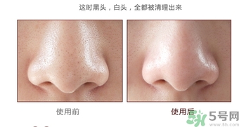 yu.r巧克力棒鼻貼怎么樣？yu.r巧克力鼻貼好用嗎？