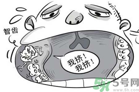 智齒一定要拔掉嗎？什么樣的智齒可以不拔？