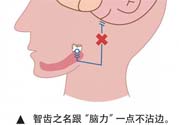 長智齒疼痛怎么辦？長智齒牙齦腫了怎么辦？