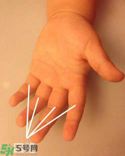 積食發(fā)燒怎么推拿？積食發(fā)燒推拿手法圖解