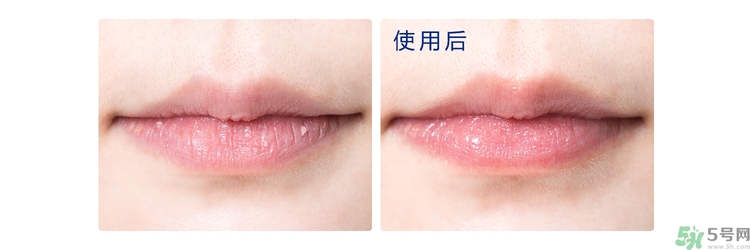 碧唇小藍(lán)罐唇膏孕婦可以用嗎？blistex碧唇小藍(lán)罐專(zhuān)柜價(jià)格