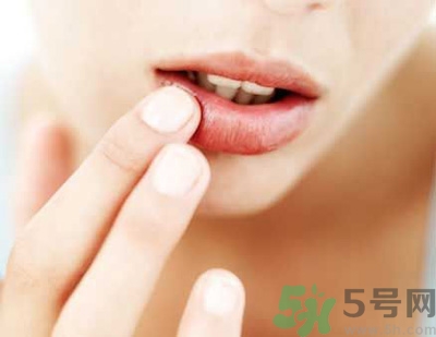 孕婦嘴唇干裂脫皮怎么回事？孕婦嘴唇干裂脫皮是缺什么