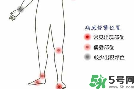 引發(fā)痛風的原因是什么？痛風病人飲食需注意什么好？