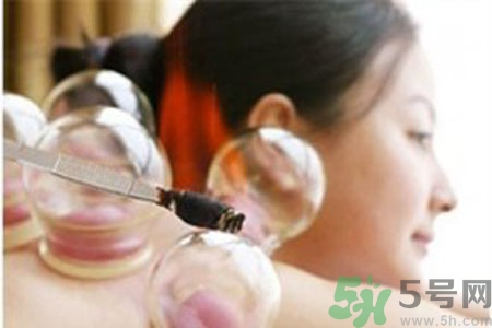 月經(jīng)可以拔火罐嗎？經(jīng)期可以拔火罐嗎？